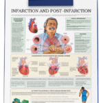 Infarction and Post-Infarction clip board