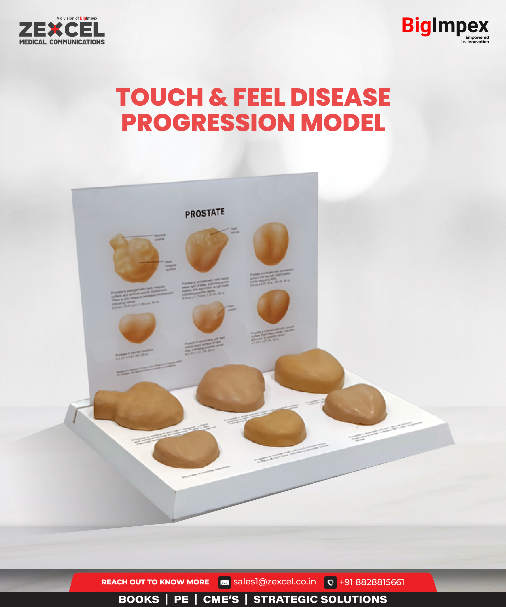 Touch & Feel disease Progression model for zexcel