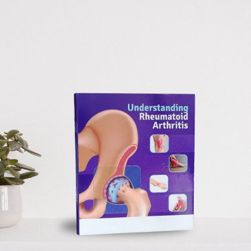 Standy printed for understanding rheumatoid arthritis