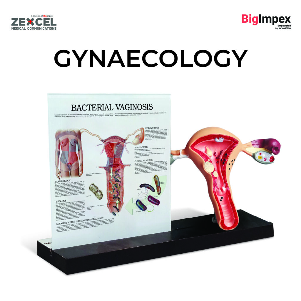 Gynecology 3D frame - Zexcel