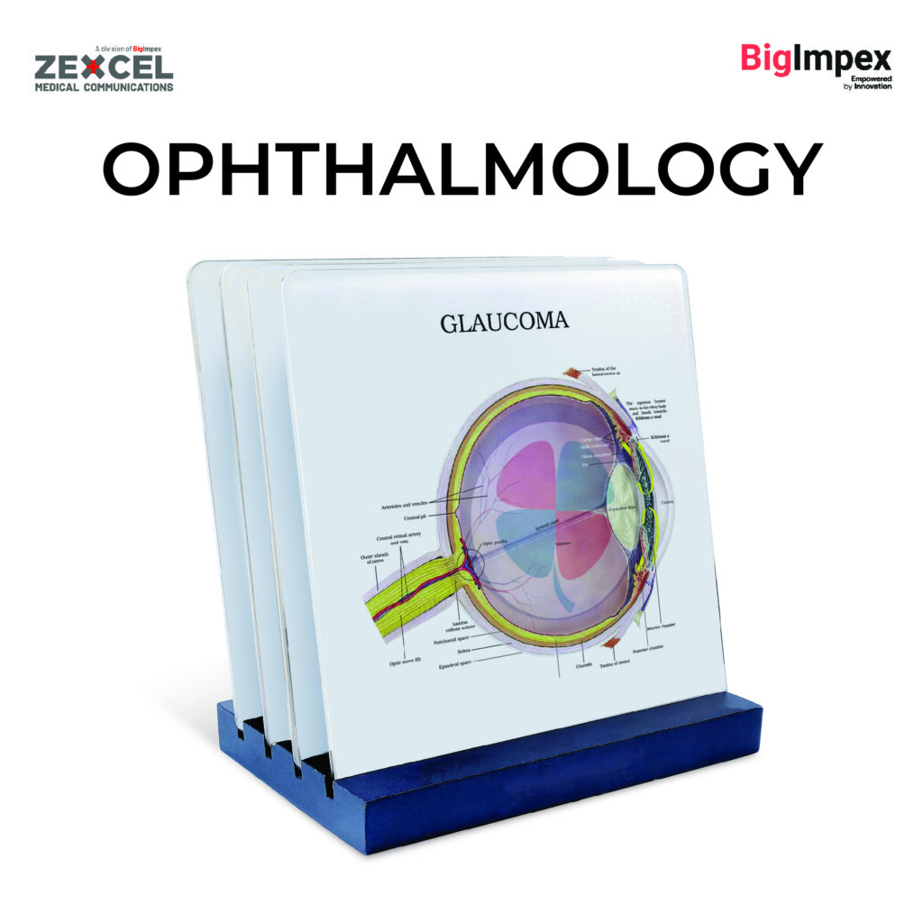 Opthalmology - glaucoma cards - Zexcel