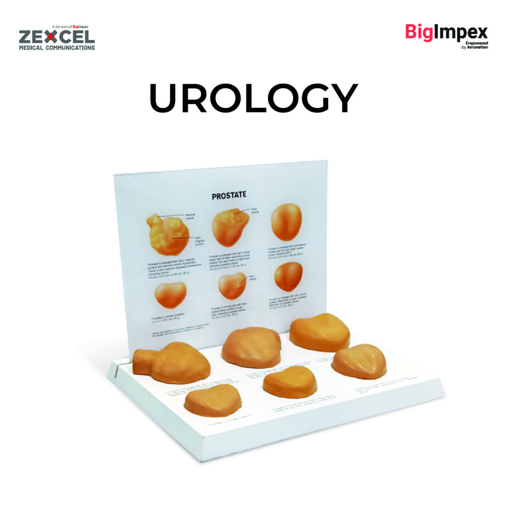 Urology - zexcel informative board